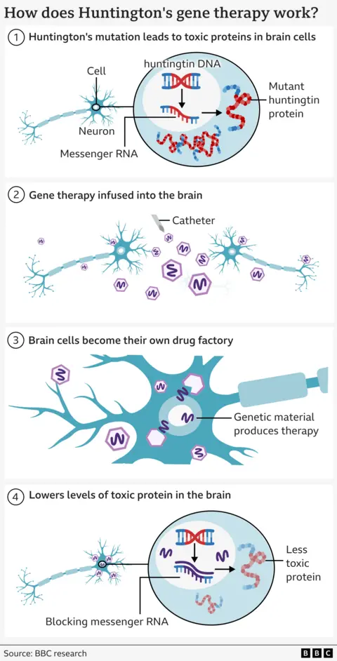 Graphical illustration of how the therapy works separated into four tiles. The first shows a spindly brain cell with a zoomed-in section showing a DNA double helix in blue with a red section denoting the mutated DNA and the build up of toxic protein, also red, inside the brain cell. Tile 2 shows two neurons and hexagonal viruses with a purple line in the middle. Tile 3 shows a close-up of the neurons from before with the viruses inside and releasing their purple squiggly line. Tile 4 goes back to the same zoomed-in view of a neuron, but this time the purple squiggles are sticking to the previous genetic code so there is less toxic protein being made, represented by it being shaded out.